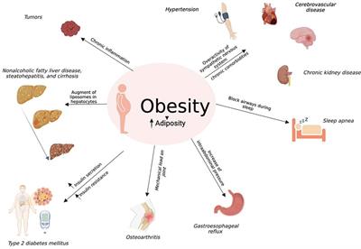 Effect of dual glucose-dependent insulinotropic peptide/glucagon-like peptide-1 receptor agonist on weight loss in subjects with obesity